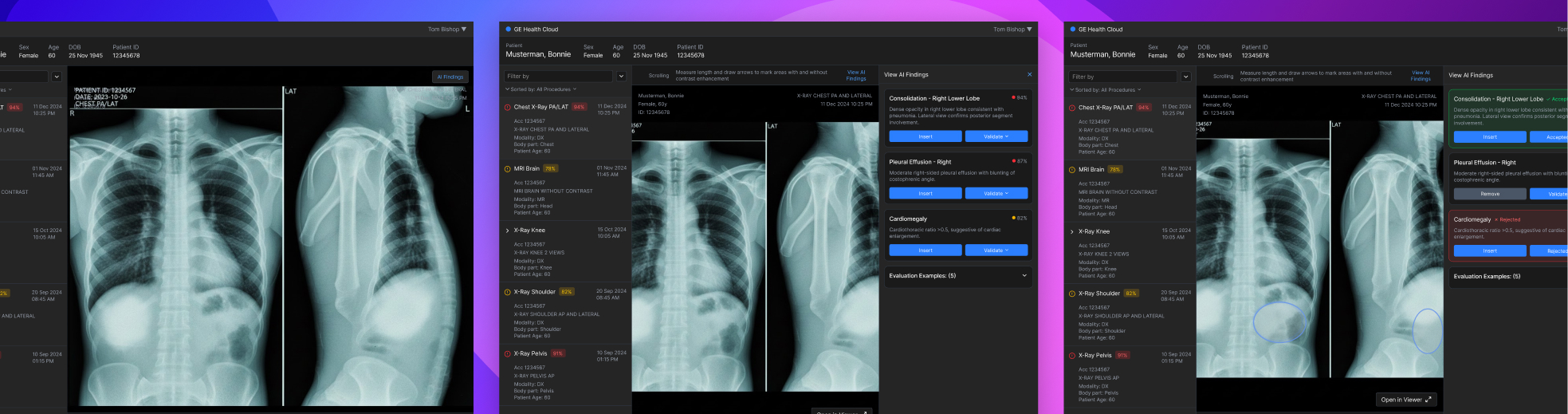 GE Healthcare
